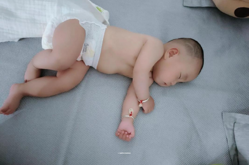 白银六个月宝宝眼睛散光